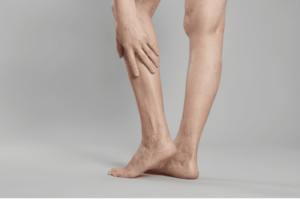 Varicose Vein Treatment In Miami