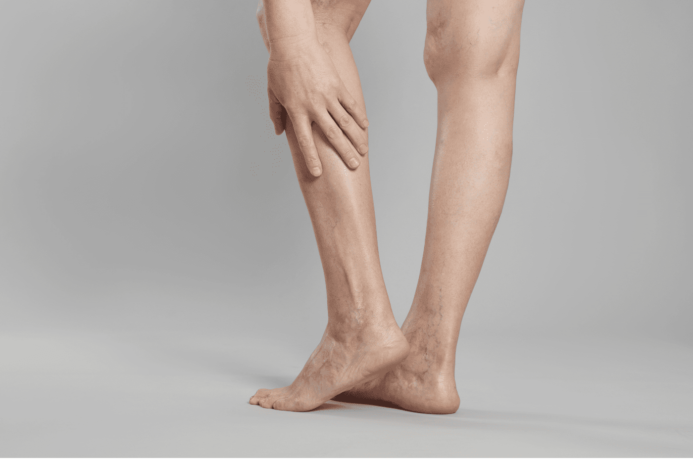 varicose vein treatment miami